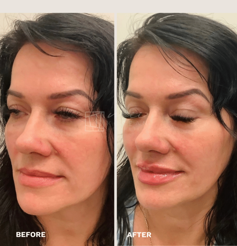 Injectables (10)