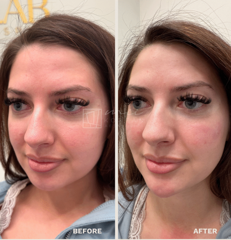 Injectables (12)