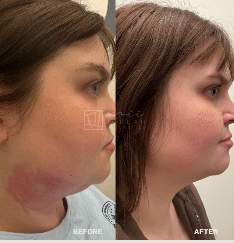 Injectables (13)