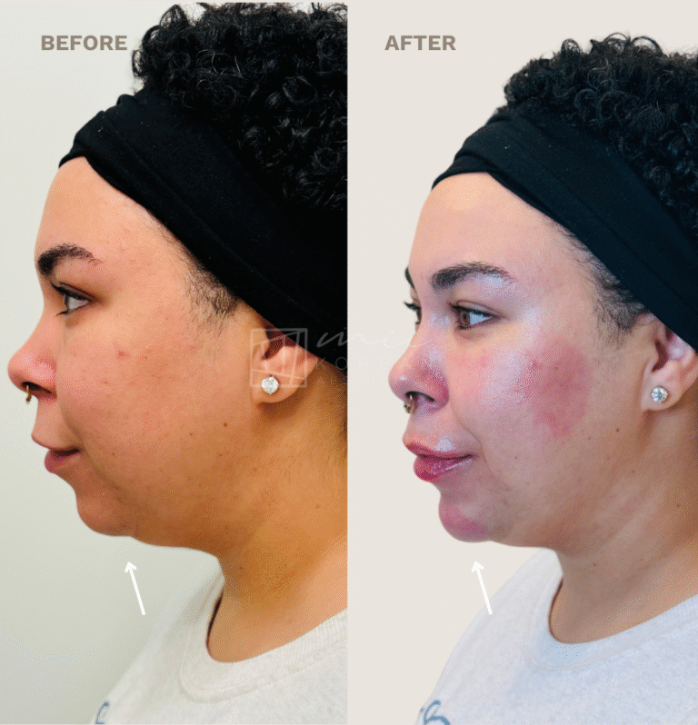Injectables (16)