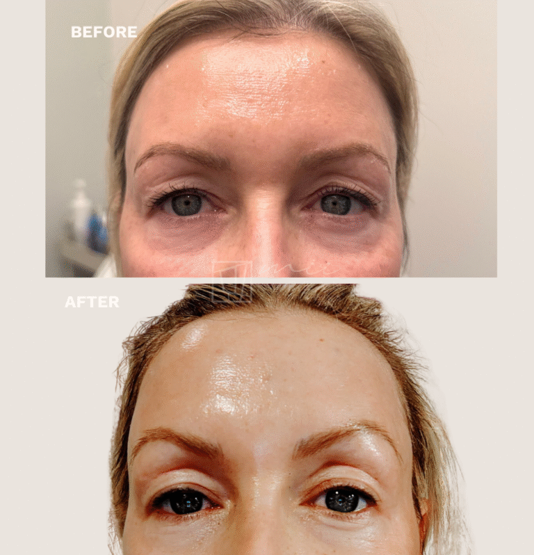 Injectables (2)