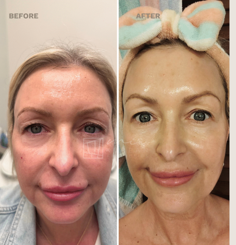 Injectables (3)