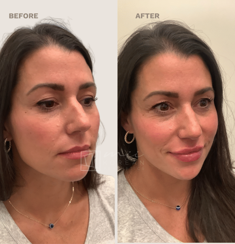 Injectables (4)
