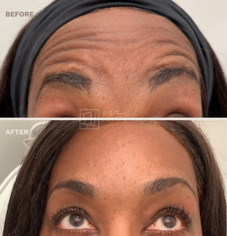 Injectables (5)