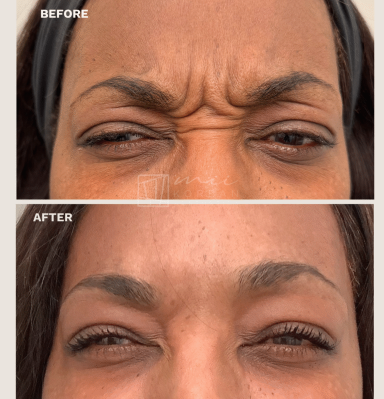 Injectables (6)