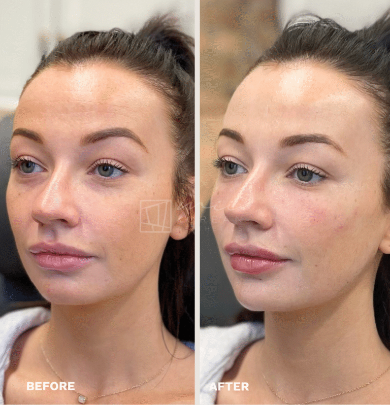 Injectables (7)