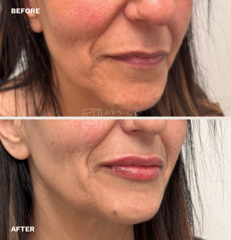 Injectables (9)