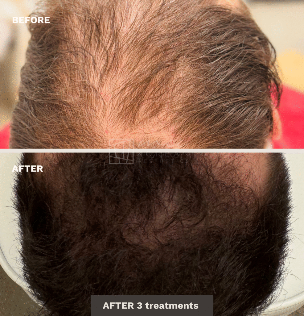 regenerative treatment (4)