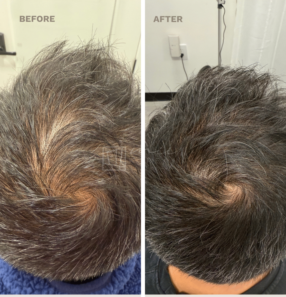 regenerative treatment (5)