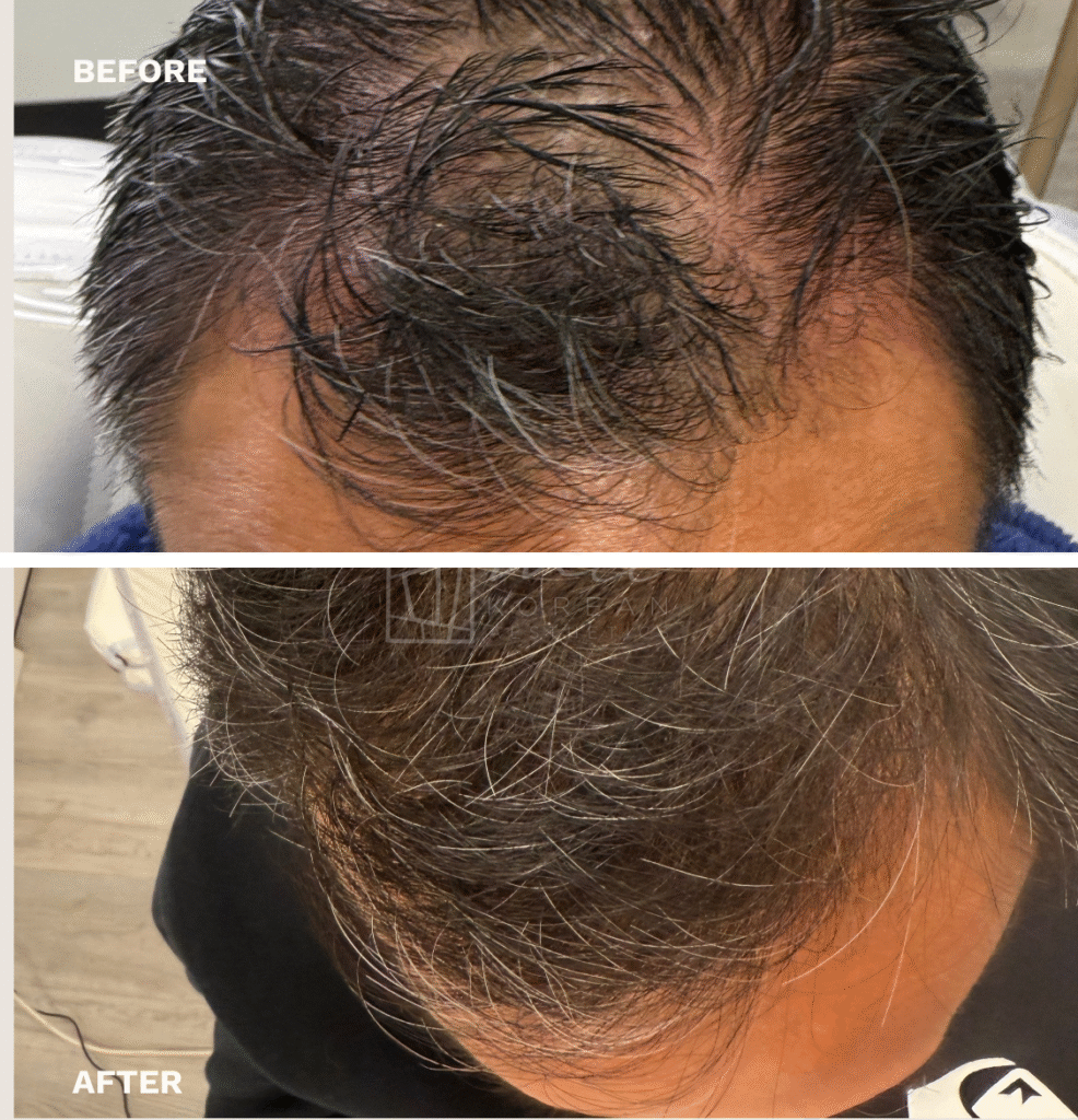 regenerative treatment (6)