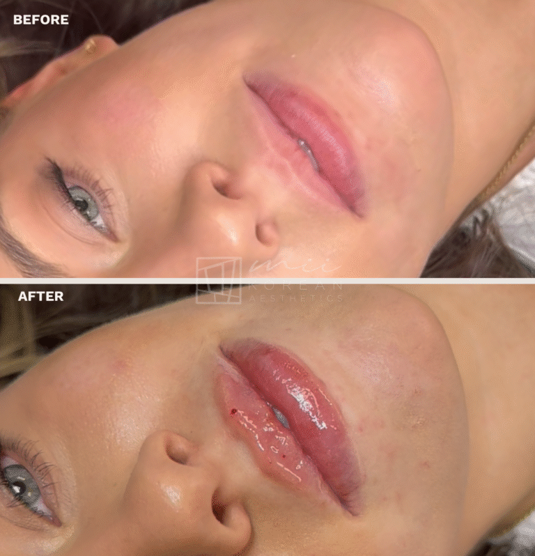 lIP (4)