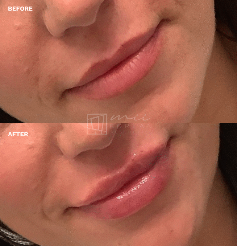 lIP (6)