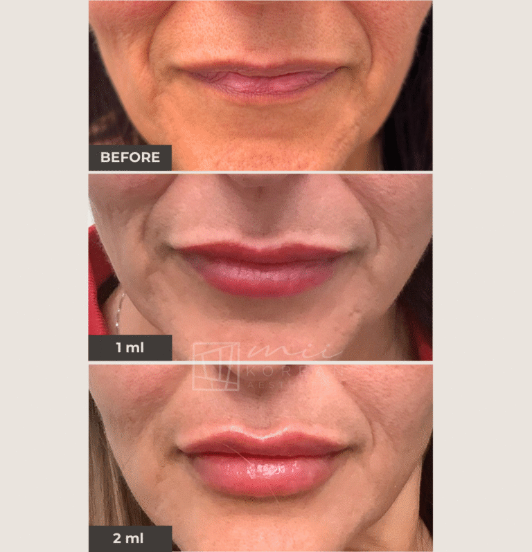 lIP (7)